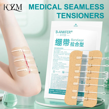Zipper Tie Wound Closure Patch Hemostatic Patch Wound Fast Without Suture Zipper Outdoor Band-Aid Portable Quick Clot Wound