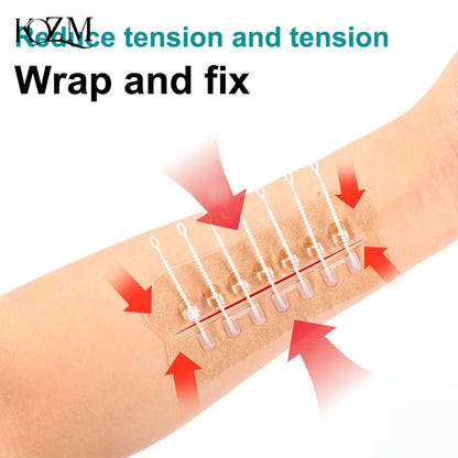 Zipper Tie Wound Closure Patch Hemostatic Patch Wound Fast Without Suture Zipper Outdoor Band-Aid Portable Quick Clot Wound
